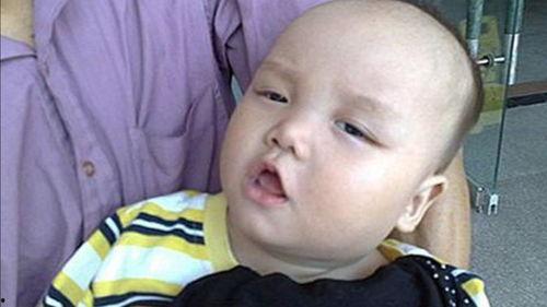 吃瓜没洗舌头疼